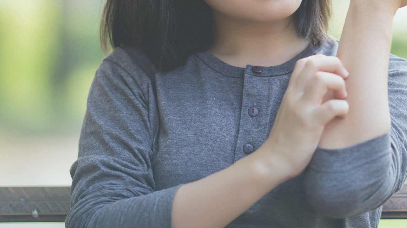 异位性皮炎痒痒抓不停,4招舒缓不适