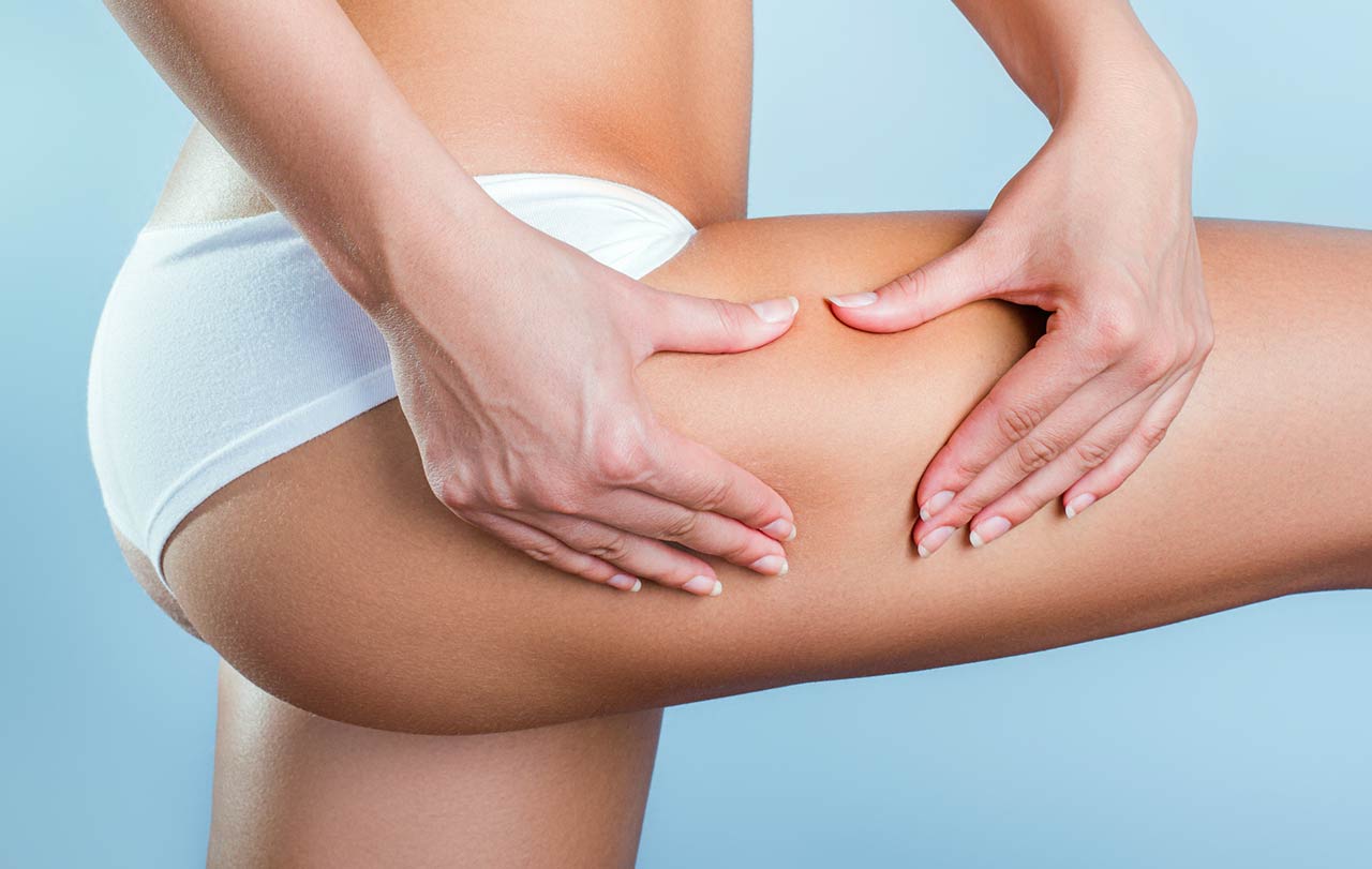 橘皮组织该如何消除?这4 种方法搭配有效