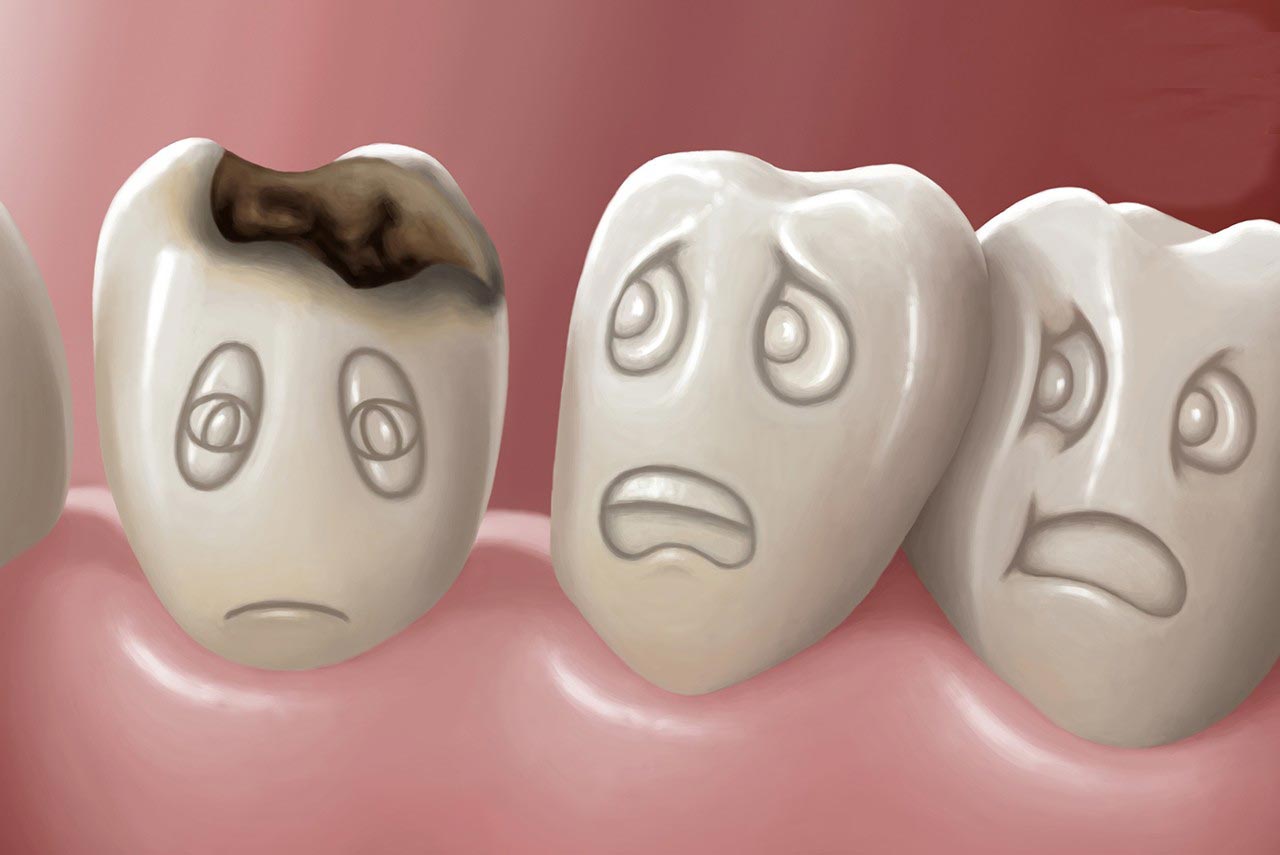 牙齿疾病是可以预防的，最容易实行的预防措施就是——认真刷牙 - 知乎